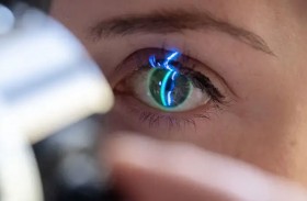 الذكاء الاصطناعي يتنبأ باحتمالات الإصابة بالمياه الزرقاء في العين