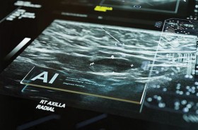 هيئة الصحة البريطانية تختبر الذكاء الاصطناعي والروبوتات لتسريع تشخيص سرطان الرئة