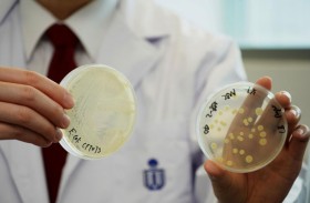 «كوليباكتين».. بكتيريا معوية قد ترتبط بسرطان القولون