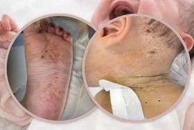 ظنت أنها تعالجه.. أم وخزت رضيعها بالإبر 600 مرة