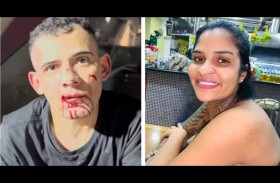 يدهس امرأة ويسحلها بسيارته 