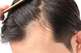 ابتكار جديد لمحاربة تساقط الشعر وتحفيز نموه